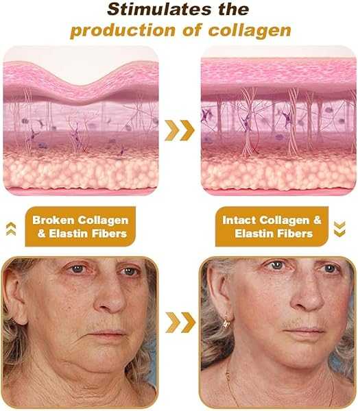 Botox Bee Venom Cream Buy 1 Get 1 Free